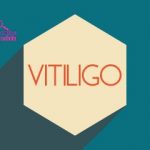 Vitiligo is a pigmentation disorder in which melanocytes (the cells that make pigment) in the skin are destroyed.